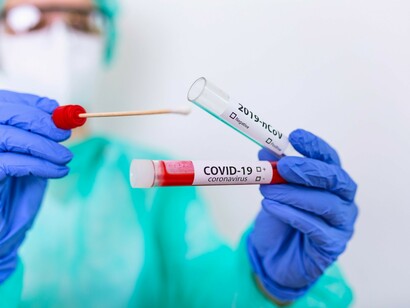 The SARS-CoV-2 virus did not start the pandemic by itself, it emerged because of human encroachment on previously untouched environments and the widespread demand for meat