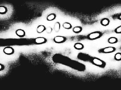 Maladie du charbon. Le bacille du charbon a la faculté de former des spores résistantes à divers traitements