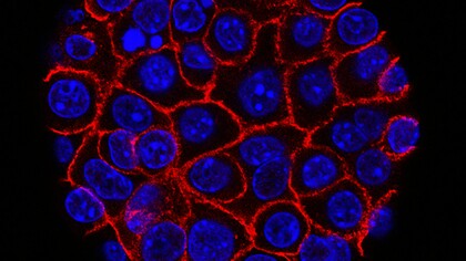 New hope for pancreatic cancer: researchers identify CAPG, a promising biomarker that could transform early detection and future treatment strategies
