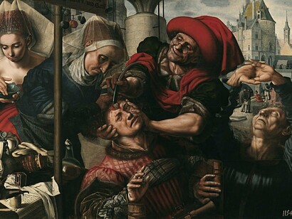 Jan Sanders van Hemessen. El cirujano. Siglo XVII