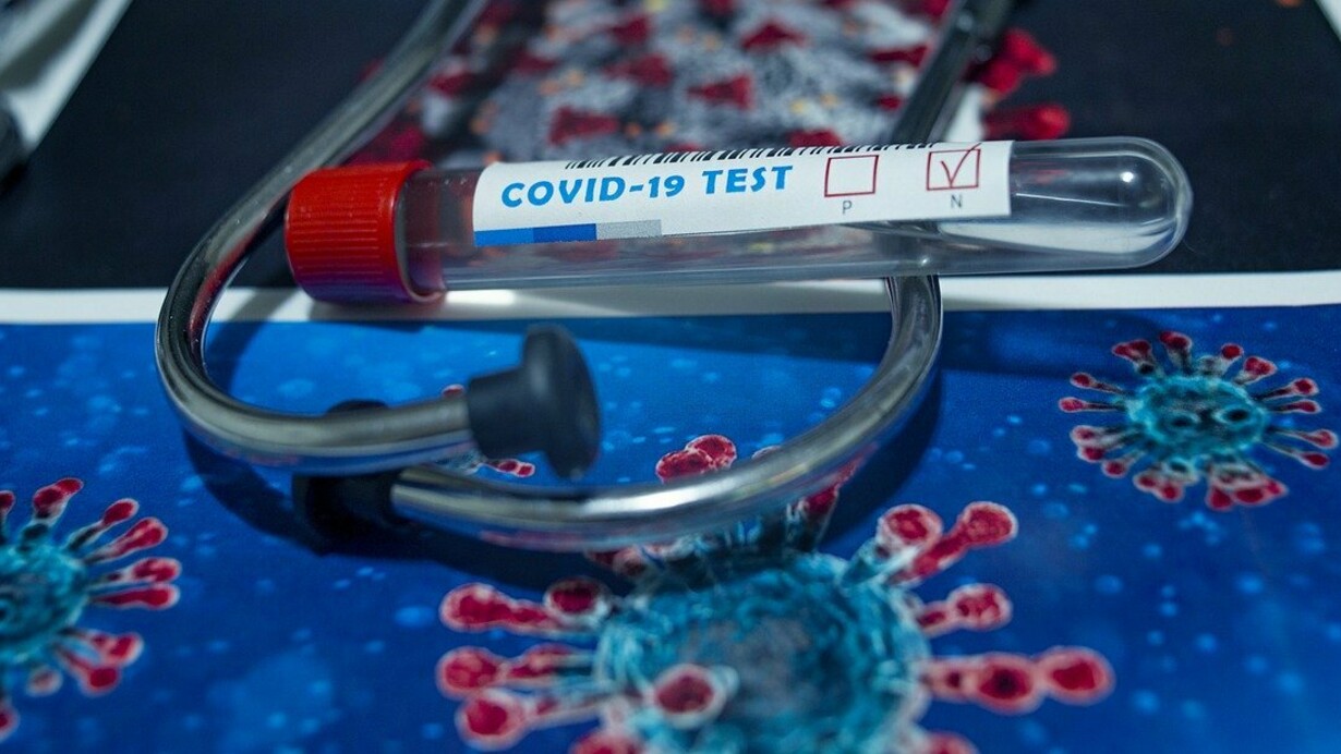 The SARS-CoV-2 has met the two basic definitions of a pandemic