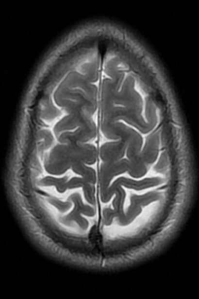 Resonancia magnética del cerebro humano