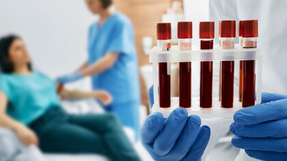La biopsia líquida ha revolucionado el diagnóstico médico al ofrecer una alternativa no invasiva para detectar y monitorear enfermedades, especialmente el cáncer