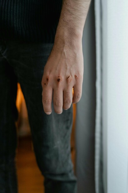 Privilégio masculino é poder sair de casa à noite, embriagar-se em um bar e voltar sem medo de ser violentado, sem receio de que o simples ato de existir lhe custe a vida. No máximo, perderá um celular, será alvo de um roubo. Mas nunca terá sua dignidade despedaçada pelo fato de ser homem. Privilégio masculino é caminhar às quatro da manhã até o ponto de ônibus, certo de que sua integridade não será violada, que seu corpo não será transformado em alvo, que sua respiração não será interrompida por mãos que se julgam donas de destinos alheios