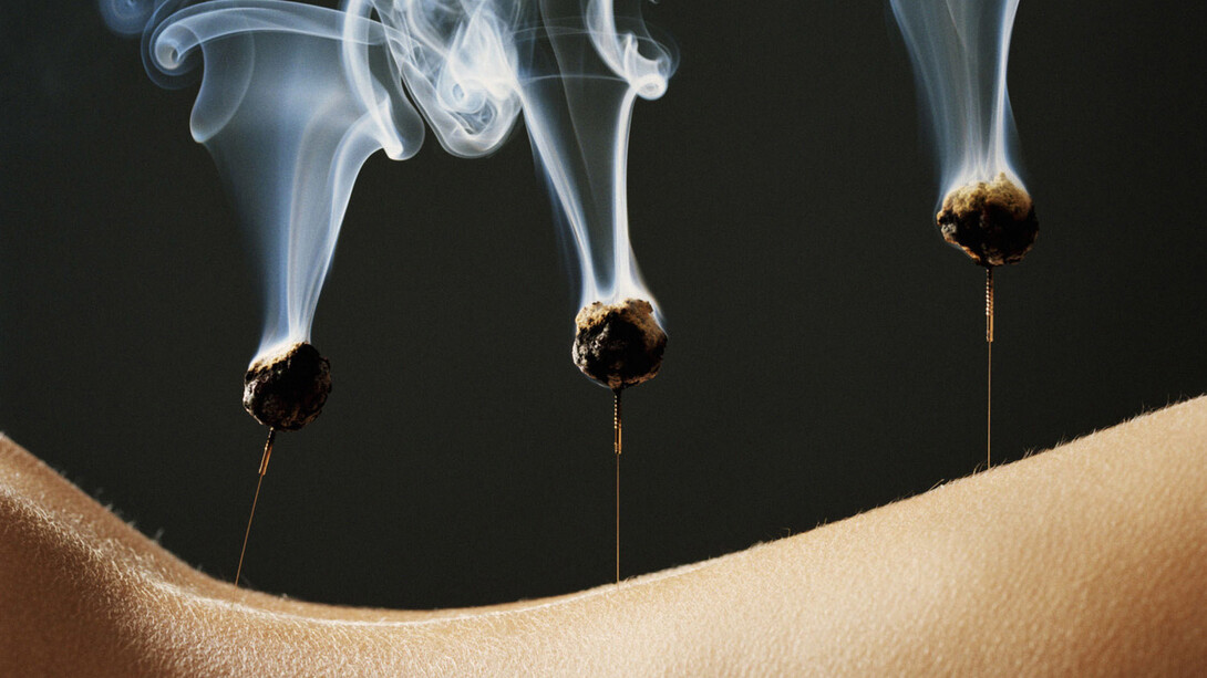 The Origin of Acupuncture & Moxibustion