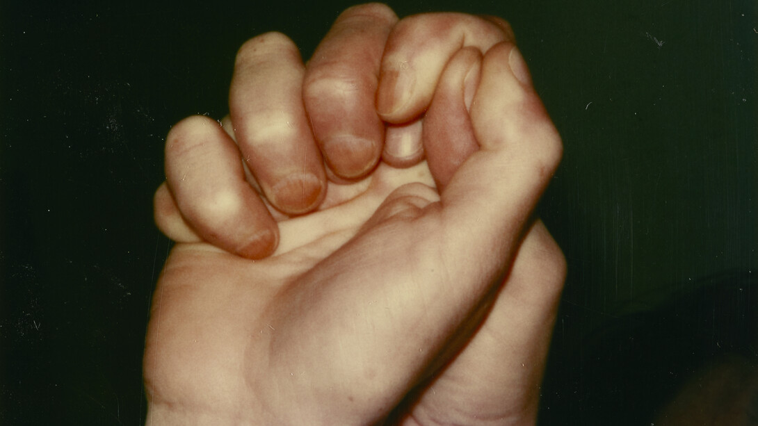 Hannah Villiger, Work, 1980. Courtesy of Meredith Rosen Gallery