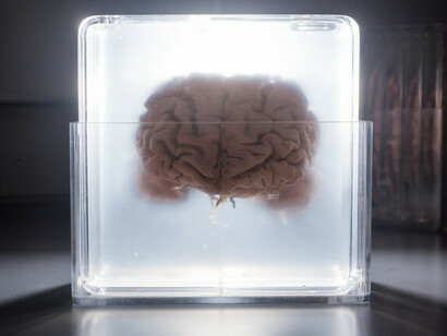 Are we brains in a vat?