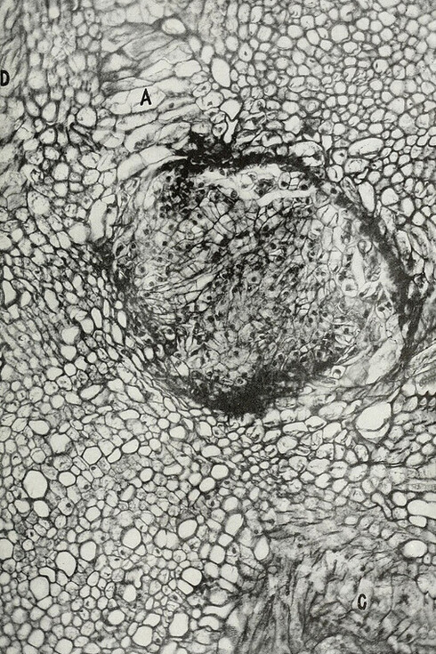 Agrobacterium tumefaciens. Bureau of Plant Industry, Soils, and Agricultural Engineering (1912). Las malformaciones visibles en el jabillo son en realidad causadas por esta bacteria, que infecta más de 600 especies vegetales