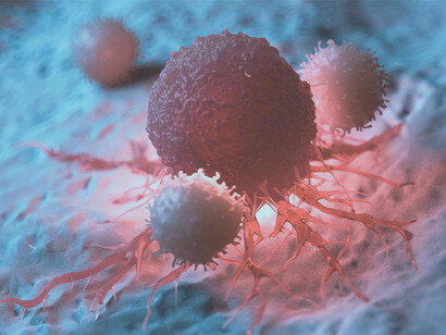 Representación de células cancerosas atacadas por linfocitos
