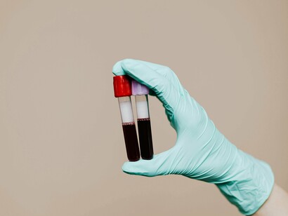 Uma das maiores revoluções no biohacking esportivo veio com o uso dos dispositivos vestíveis — os chamados wearables. Relógios inteligentes, pulseiras e sensores são capazes de monitorar uma série de indicadores fisiológicos em tempo real, como a frequência cardíaca, a variabilidade da frequência cardíaca (HRV), o padrão e qualidade do sono, além de medir níveis de estresse e oxigenação do sangue. Esses dados fornecem uma visão detalhada do estado físico e mental do atleta, permitindo ajustes no treinamento e nos períodos de descanso para evitar a fadiga excessiva e lesões