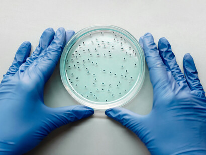 Aunque algunas bacterias causan enfermedades, la mayoría cumple funciones beneficiosas en el cuerpo humano y en la naturaleza