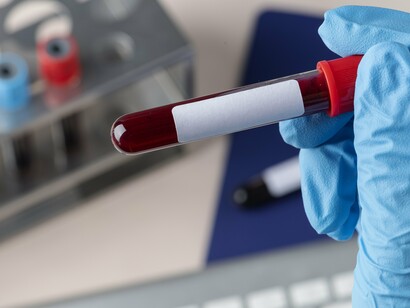 Biochemical research bridges scales—from test tube to systems biology, from structure to cure