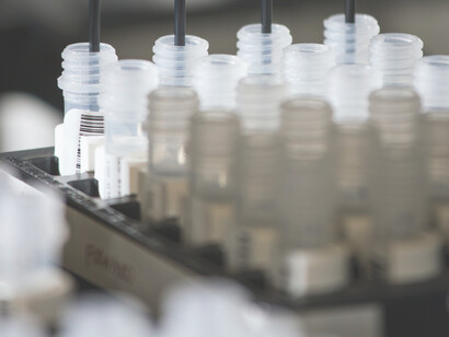 Eine auswahl von DNA-Proben zur amplifikation im cancer genomics research laboratory