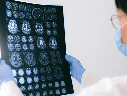 Les écrans n’agissent pas seulement sur nos habitudes, mais aussi sur les mécanismes cérébraux qui régulent sommeil, mémoire et concentration