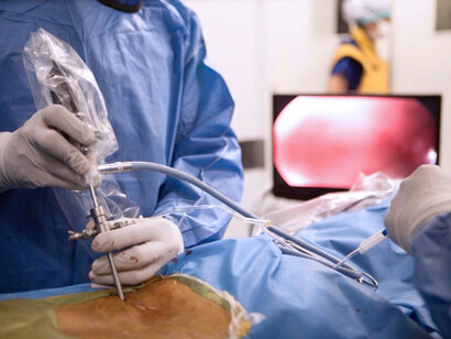 Cirugía endoscópica de columna