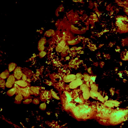 Filoxera succionando savia en raíz de vid