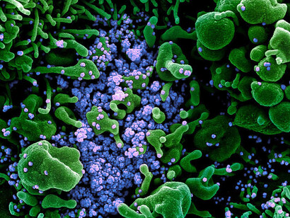 Desconocemos muchos aspectos evolutivos del llamado coronavirus, aunque ya conocemos cuales son los factores sociales que favorecen su difusión