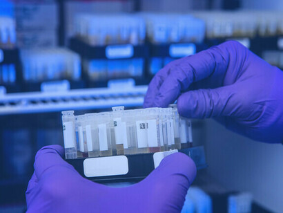 Covid-19 dominiert die Nachrichten