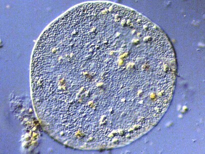 Myxozoa al microscopio