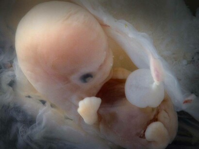 Embrione a circa 7 settimane di età gestazionale