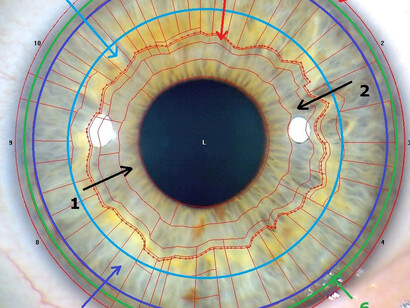 Le meraviglie dell'iridologia