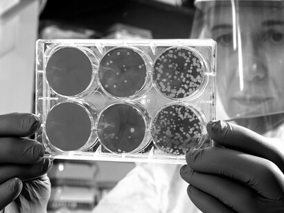 Un científico en el laboratorio con los resultados de un análisis de placa