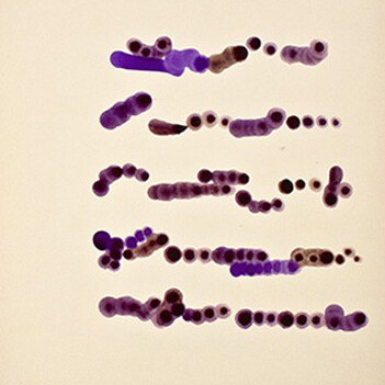 Mirtha Dermisache. Courtesy of Malba