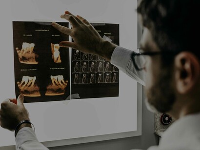 X-ray scans are the fundamental assets in the field of dentistry to help locate the problem