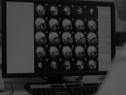 A radiologist examining a CT scan alongside neuroimaging studies