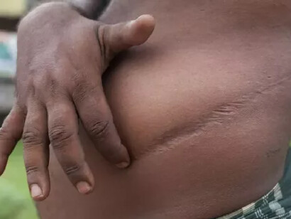 Trafic d'organes. Il faut juste enlever les reins de cette petite fille, puis remplir son corps de marchandises. C’est plus discret que de voyager avec un cadavre de nourrisson