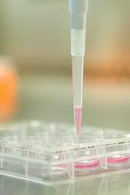 A cell culture plate with induced pluripotent stem cells, the regenerative powerhouses at the heart of innovative therapies, offering hope for chronic joint pain and inflammatory arthritis