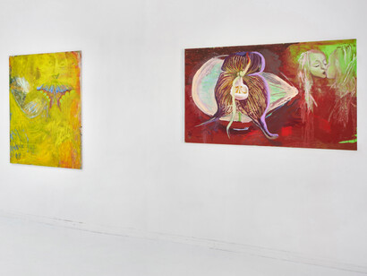 Sofya Shpurova, I’m a surgeon, maybe just of some other kind, exhibition view. Courtesy of Lubov