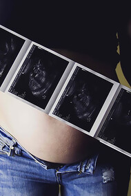 A teenage mother holding her ultrasound results, with a photo of her baby bump, reflecting the challenges of teenage pregnancy