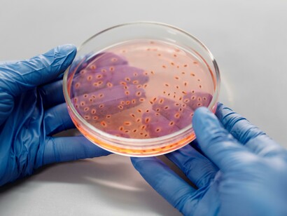 A person wearing gloves holding an agar plate. Nanodiagnostic techniques can gain an understanding of diseases on a cellular level 