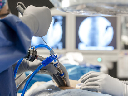 Cirugía endoscópica de columna