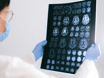 A doctor pointing to a brain MRI scan displayed on a monitor