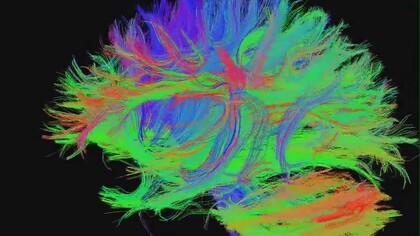 Conectoma: mapa detallado y exhaustivo de todas las conexiones neuronales que existen en un  un cerebro