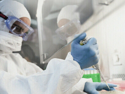 Das NeoCoV ist ein Coronavirus, das dem Coronavirus namens MERS-CoV sehr ähnlich ist, das 2012 das Middle East Respiratory Syndrome (MERS) verursachte