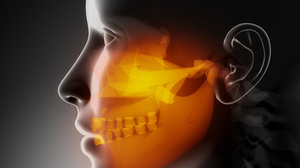 L'utilizzo dei bite in odontoiatria e posturologia