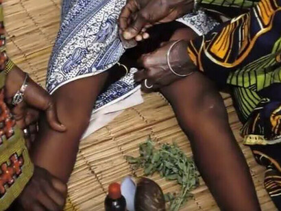 Mutilazioni genitali femminili. I ripetuti interventi di sensibilizzazione della Comunità internazionale, per intraprendere azioni e iniziative di prevenzione e contrasto contro le MGF, hanno fatto ridurre sensibilmente il fenomeno e in alcuni paesi hanno determinato la proibizione per legge di tale pratica