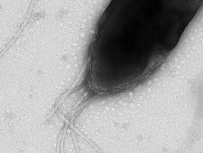 Micrografia eletrônica de uma bactéria do gênero Pseudomonas, evidenciando seu flagelo polar, estrutura responsável pela locomoção. Espécies desse gênero estão entre os microrganismos mais estudados pelo potencial de promover o crescimento das plantas e contribuir para uma agricultura mais sustentável