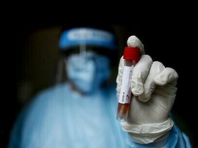 Die Omicron-Variante des SARS-CoV-2-Virus beherrschte die Schlagzeilen