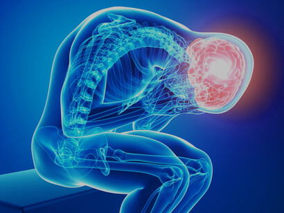 Las migrañas son cefaleas severamente incapacitantes y algunas personas  experimentan aura
