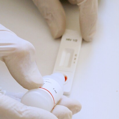 I test POCT risultano particolarmente utili nella gestione delle cronicità, delle urgenze territoriali e dei pazienti fragili