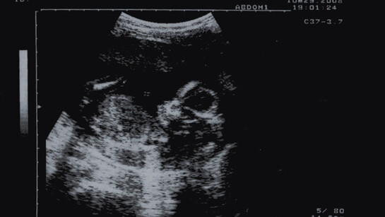 Infanticide, cover