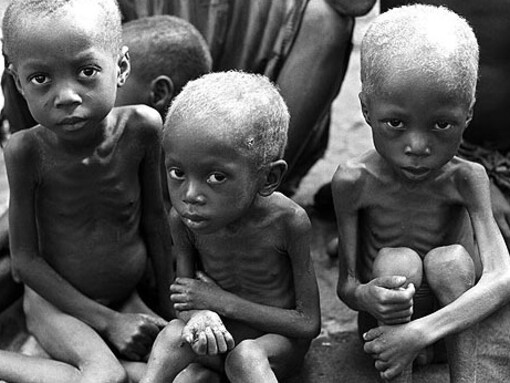 Unos tan poco... la desnutrición infantil es una lacra que afecta a numerosos países pobres