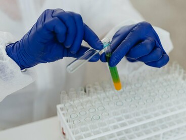 Amostra é analisada por pesquisador durante um experimento laboratorial voltado à produção de conhecimento. Além de desenvolver novas soluções, proteger a propriedade intelectual é um passo importante para que a inovação alcance o mercado e beneficie a população