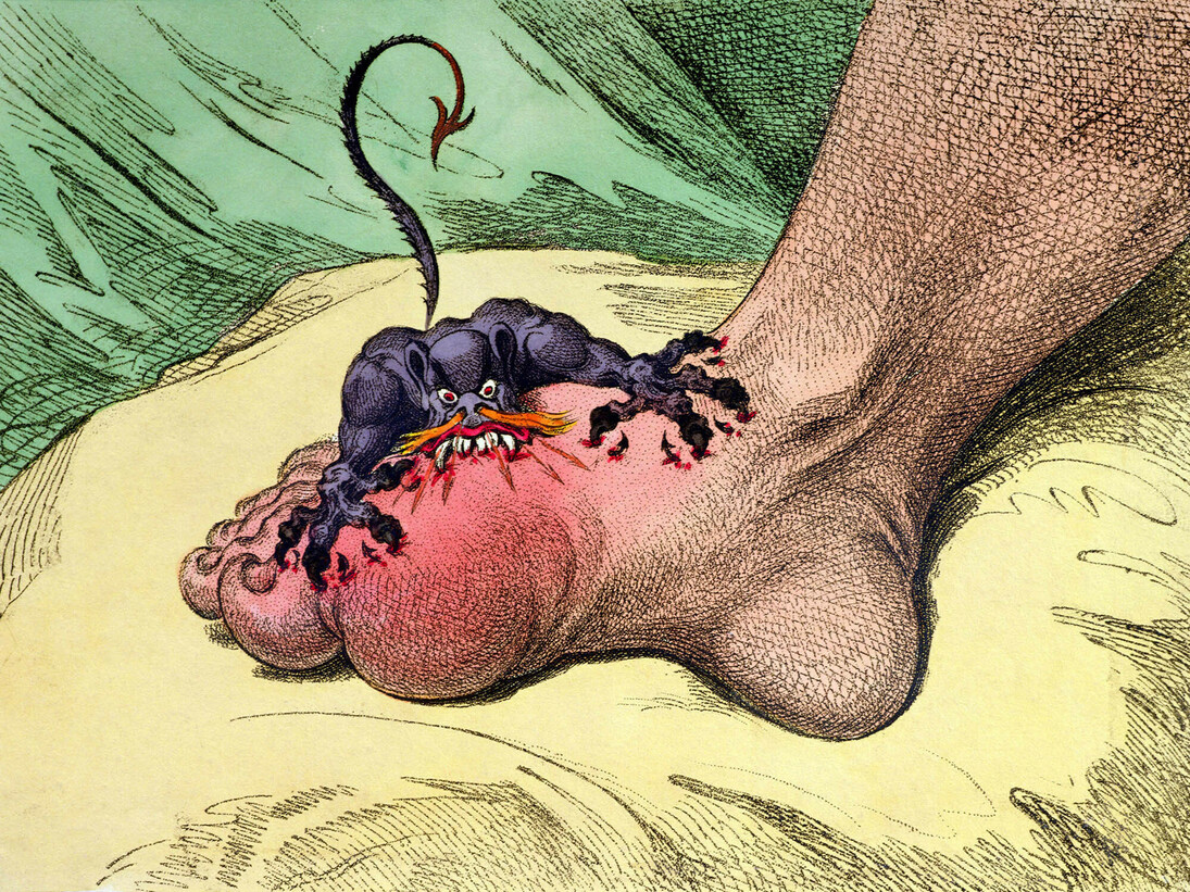 James Gillray (1757‒1815), The Gout, 1799, Hand-coloured soft ground etching, 26 x 35.5 cm © Courtesy of the Warden and Scholars of New College, Oxford / Bridgeman Images