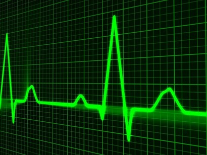 ECG: La maggior parte degli episodi sincopali afferenti alle strutture ospedaliere coinvolgono soggetti di oltre 65 anni e il 30% circa degli anziani istituzionalizzati presentano episodi ricorrenti