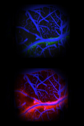 El rojo representa el mayor flujo en un animal dormido, mientras que el verde representa inversamente flujo restringido en el mismo animal despierto